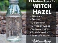 11 Natural Uses for Witch Hazel 200x150