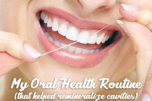 My oral health routine that helped me remineralize cavities 300x200