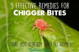 Proven Natural Remedies for Chigger Bites (& How to Avoid)