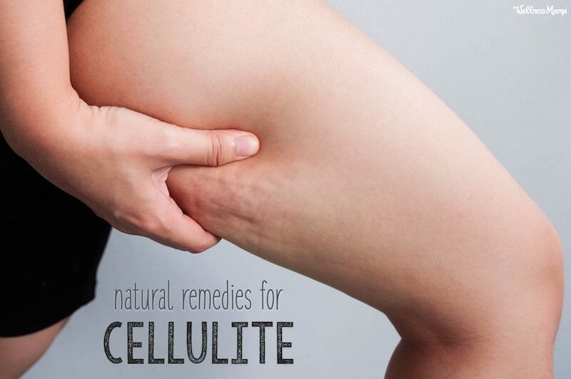 9 Natural Remedies To Get Rid Of Cellulite Wellness Mama