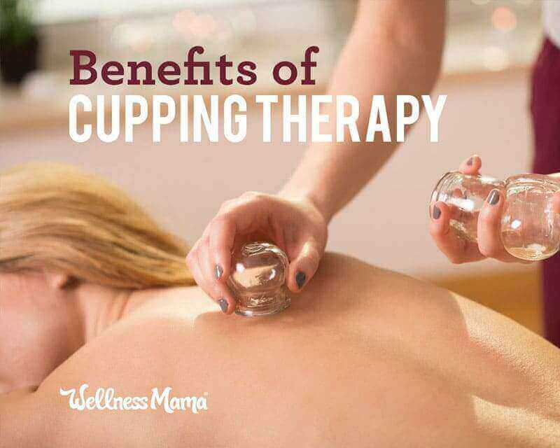 Cupping therapy- does it work and important cautions