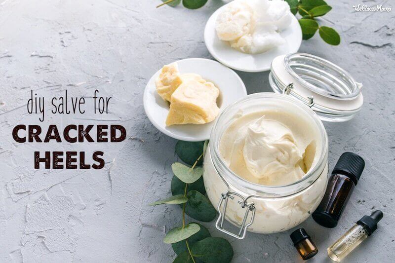 Soothing DIY Salve for Cracked Heels