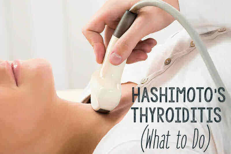 Hashimotos Disease- what to do