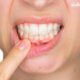 How gum disease affects the whole body