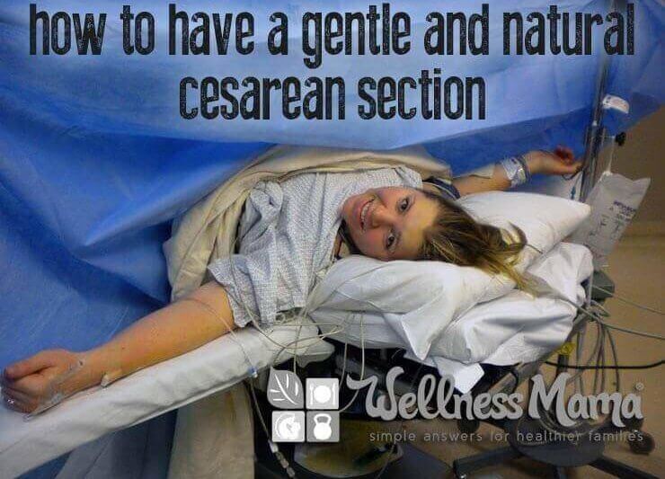 How To Have A Natural And Gentle Cesarean Wellness Mama