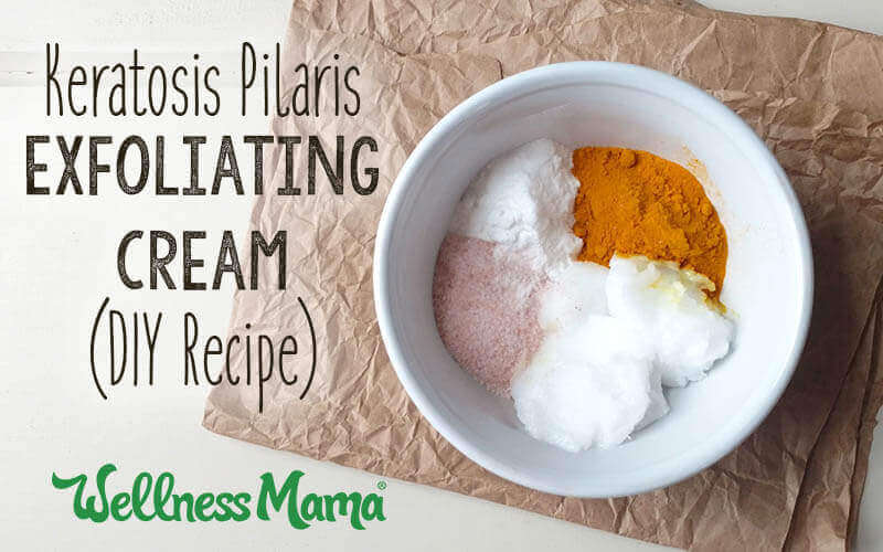 Keratosis Pilaris Exfoliating Cream-DIY Recipe