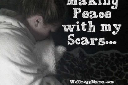 Making Peace with my scars