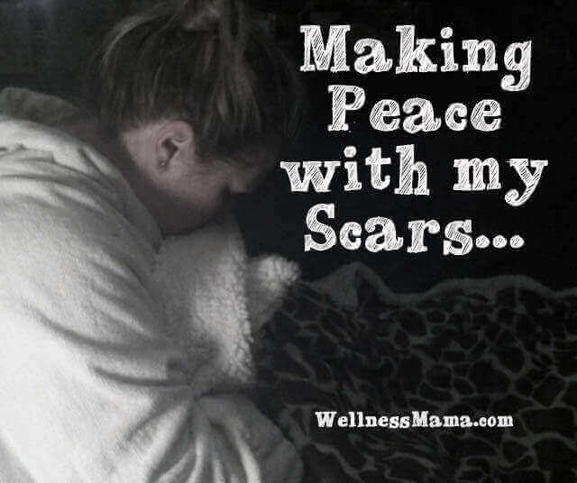 Making Peace with my scars