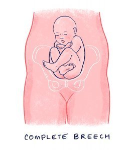 Mama-Natural-book-fear-about-childbirth-baby-is-breech