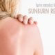 what to do for a sunburn home remedies