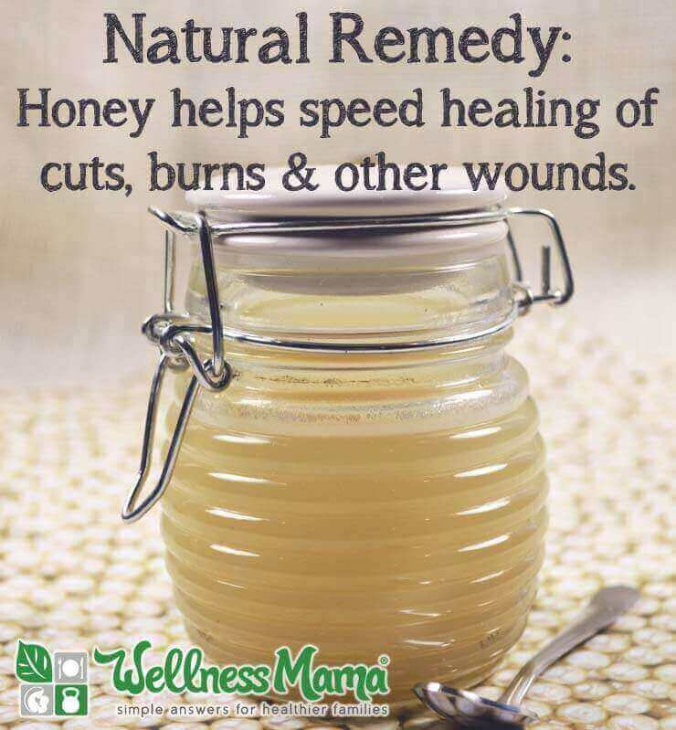 Honey for Healing Cuts and Burns
