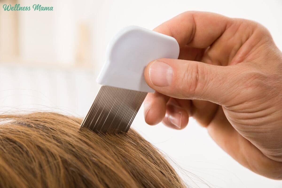 Natural Ways to Prevent & Get Rid of Head Lice | Wellness Mama