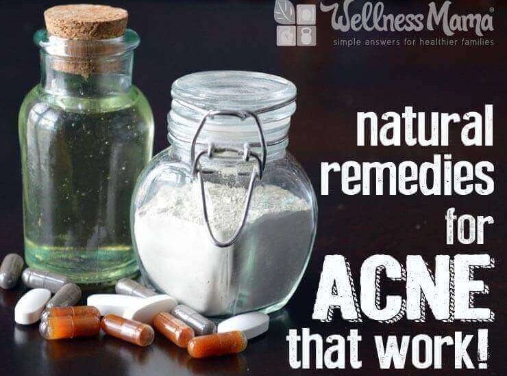 Natural remedies for acne that really work