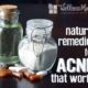 Natural remedies for acne that really work