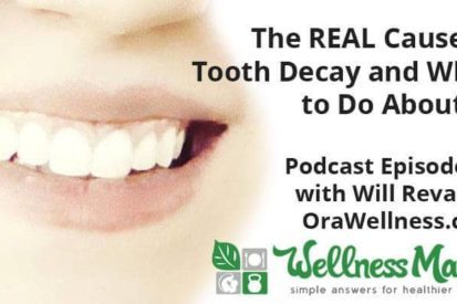 The Real Cause of Tooth Decay and What to Do About It