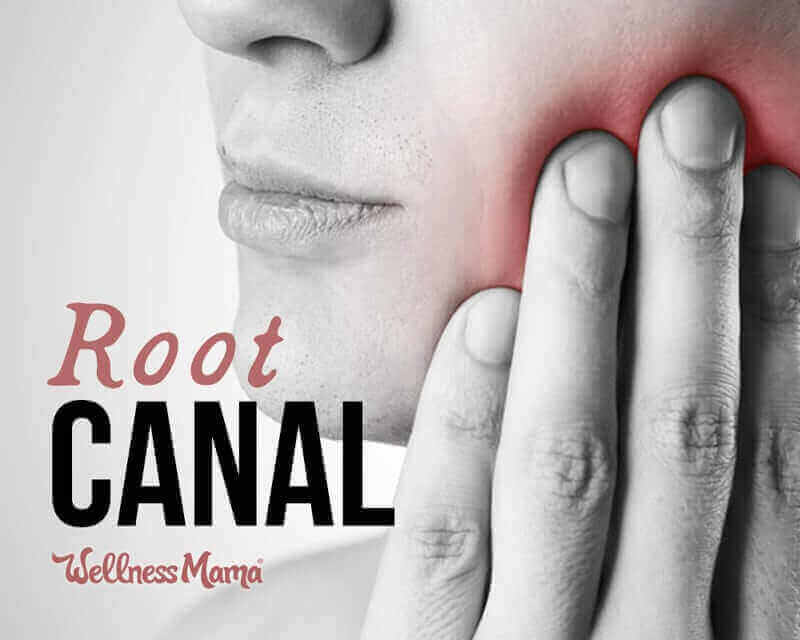 Root Canal: Dangerous or Just Misunderstood?
