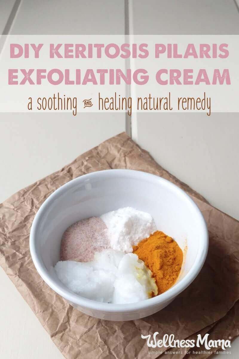 Ever notice little red bumps on the backs of your arms? It is a skin condition called keratosis pilaris. Learn how to make a simple cream to combat it.
