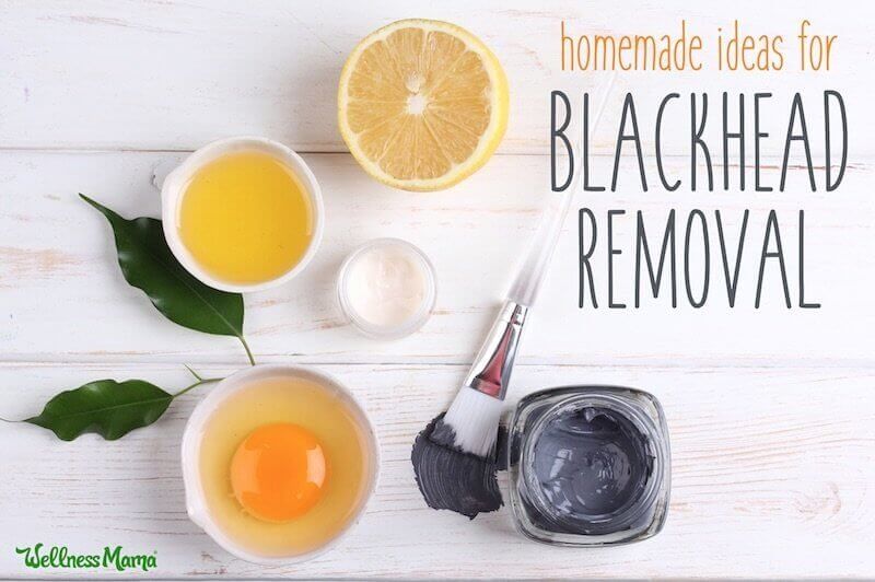 DIY Remedies for Blackhead Removal