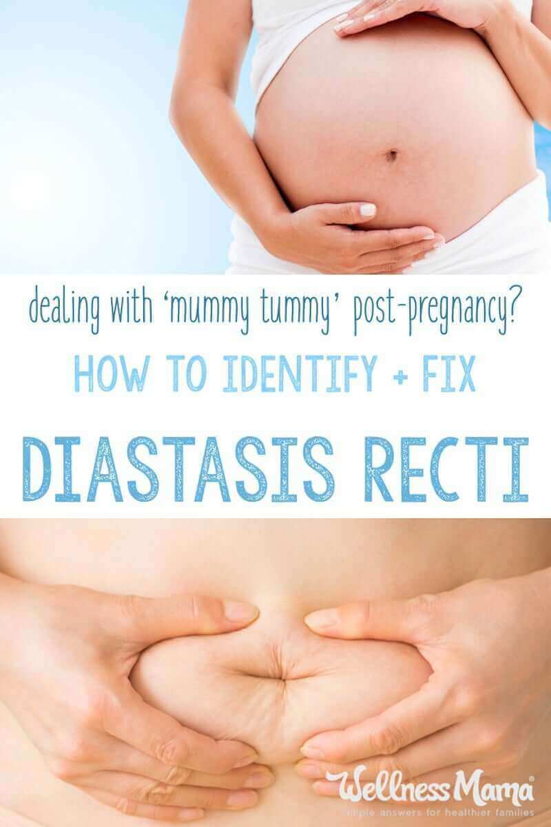 Diastasis Recti is a condition of the abdominal muscles that can occur after pregnancy. Find out how to know if you have it and what to do.