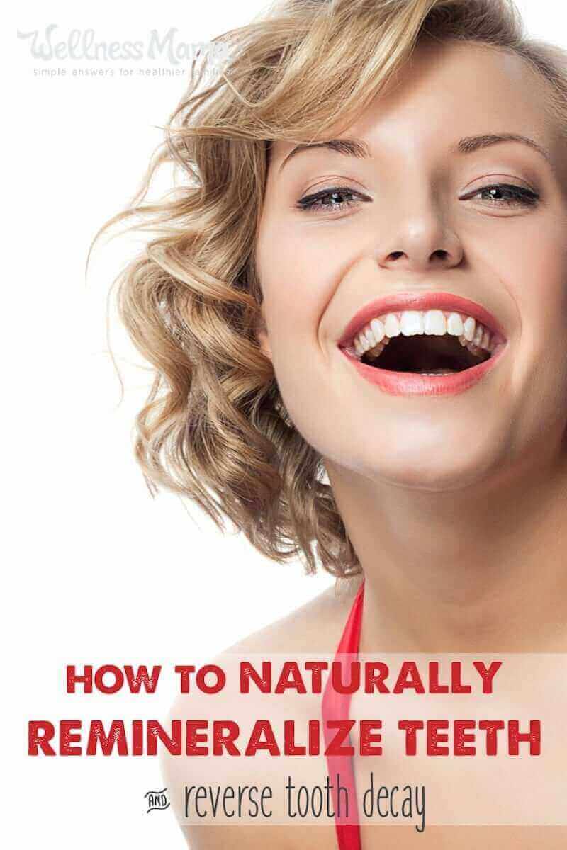 Did you know it's possible to remineralize teeth naturally? Teeth must be taken care of from the inside as well as the outside. This is how you do it.