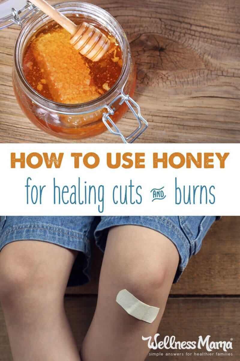 Research supports the use of honey for healing cuts, burns, puncture wounds because of its natural antibacterial properties.