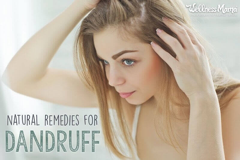 Natural Remedies for Dandruff