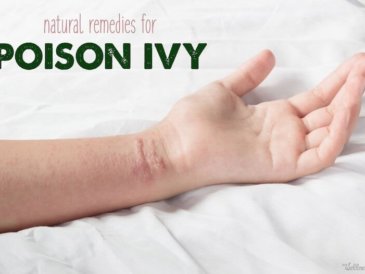 how to get rid of poison ivy
