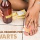 Natural remedies for warts