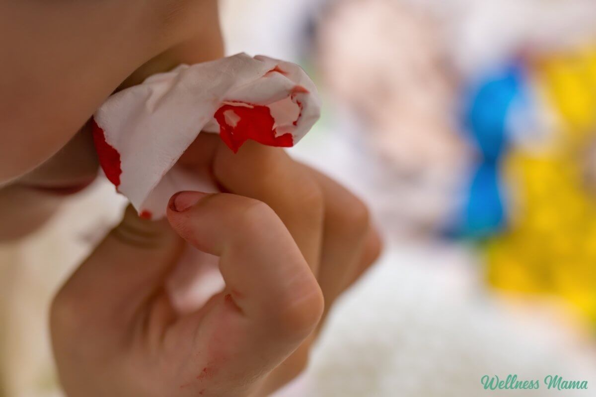 What Causes Nosebleeds in Adults and Kids (+ Natural Remedies)