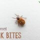 How to prevent tick bites