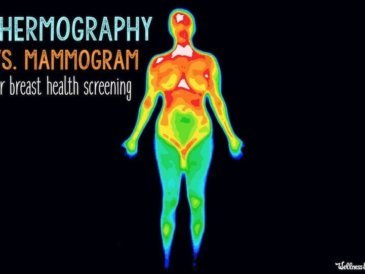 thermography vs mammogram