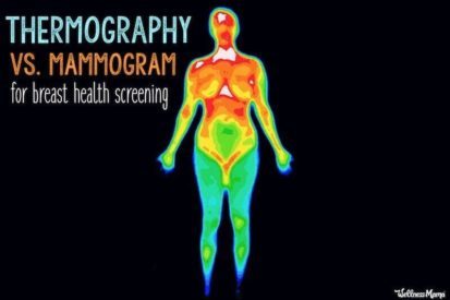 thermography vs mammogram