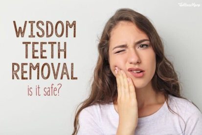 wisdom tooth extraction surgery