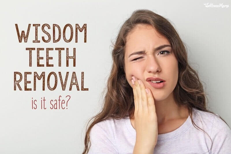 Is Wisdom Tooth Removal Worth the Risk?
